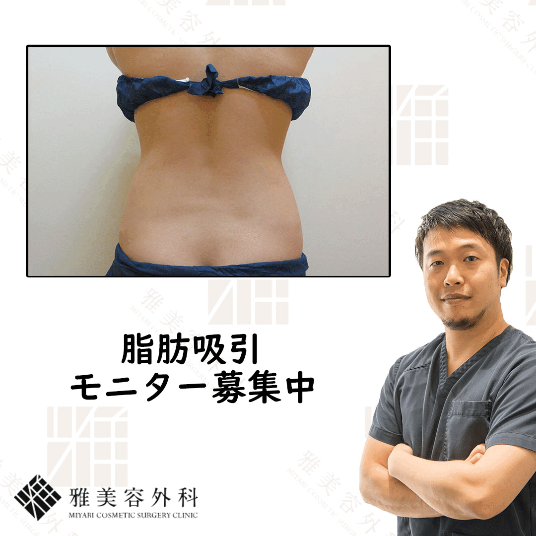 パンティラインgif 腹部・背中の脂肪吸引【Tさん】くびれ|脂肪吸引ブログ【大阪雅クリニック公式】